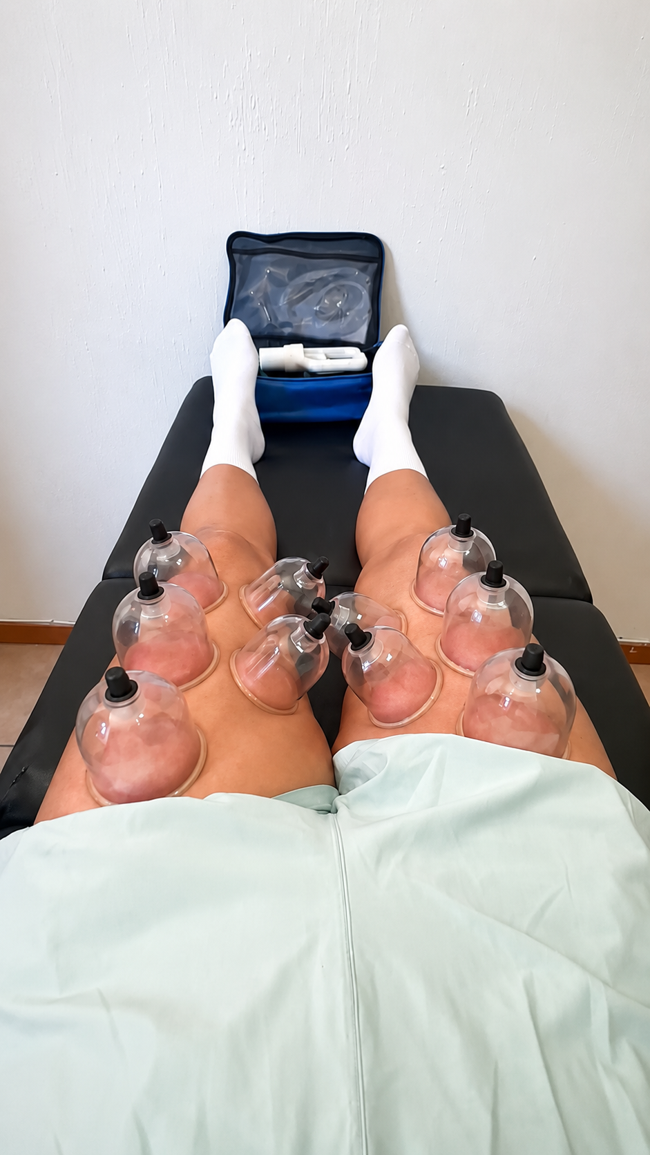 Ventosas de vacío para liberación miofascial en rodillas en Motion Lab